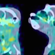Illustration for article titled New Technique Reveals Where AIDS Hides In The Body – In Real Time